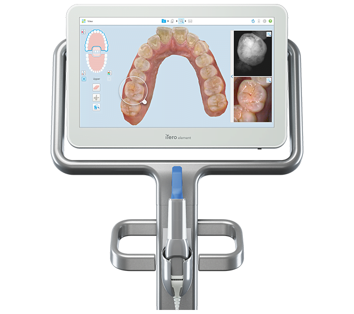 iTero Element 2 scanner