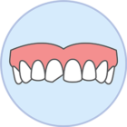 Chipped Teeth Showcase