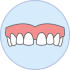 Gaps Teeth Showcase