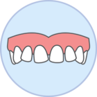Uneven Teeth Showcase